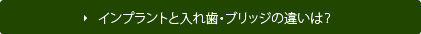 インプラントと入れ歯・ブリッジの違いは？